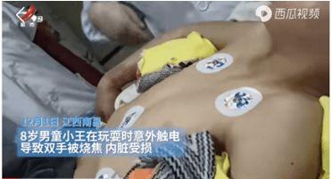 儿童触电事故视频,从触电事故视频中汲取教训